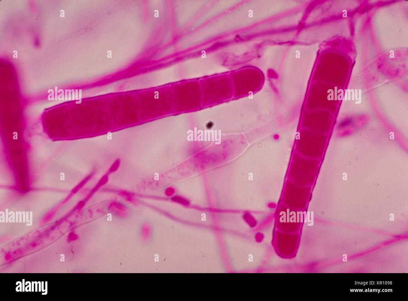 Diese photomicrograph zeigt die microconidia der Pilz Trichophyton mariatii, 1979. Viele Mitglieder der Gattung Trichophyton bevölkern die Erde, Menschen oder Tiere und sind eine der Hauptursachen für Dermatophytosis beim Menschen. Dies ist eine Infektion der Haut, Haare und Nägel durch die Pilze?s Fähigkeit, Keratin zu nutzen. Bild mit freundlicher Genehmigung von CDC/Dr. Arvind A. Padhye. Stockfoto