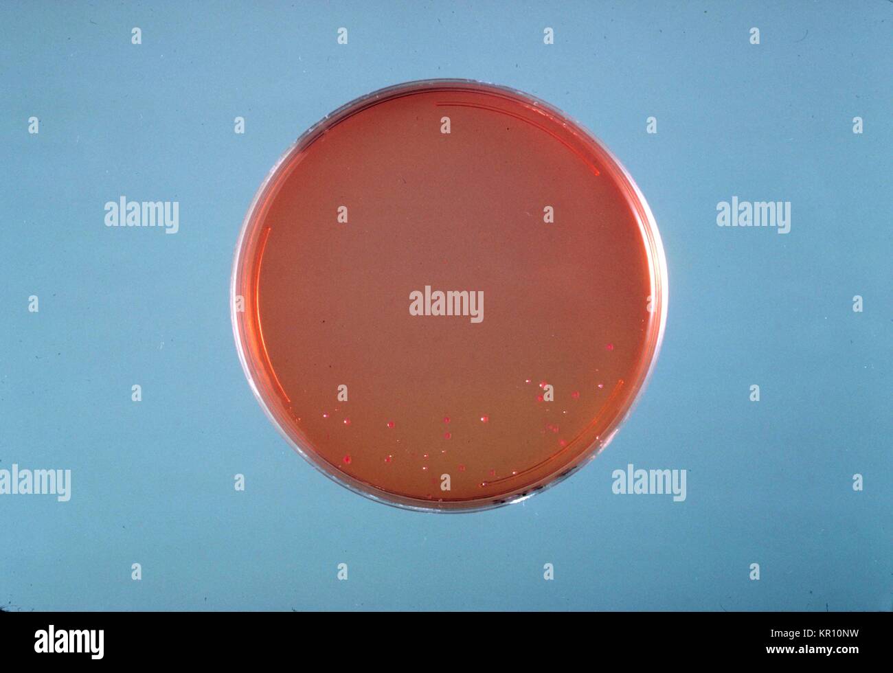 Dies ist ein SS Agarplatte Kultur von Enterobacter sakazakii nach 24 Stunden das Wachstum bei 36<sup> {Grad}</sup> C. Enterobacter sakazakii, ein gram-negative, stabförmige Bakterien, wird von der Familie Enterobacteriaceae, 1978. E. Sakazakii ist mit einer seltenen, aber häufig tödlichen Form der neonatalen Meningitis mit einer Sterblichkeit von 40 bis zu 80 Prozent verbunden. Bild mit freundlicher Genehmigung von CDC/Dr. J.J.Bauer. Stockfoto