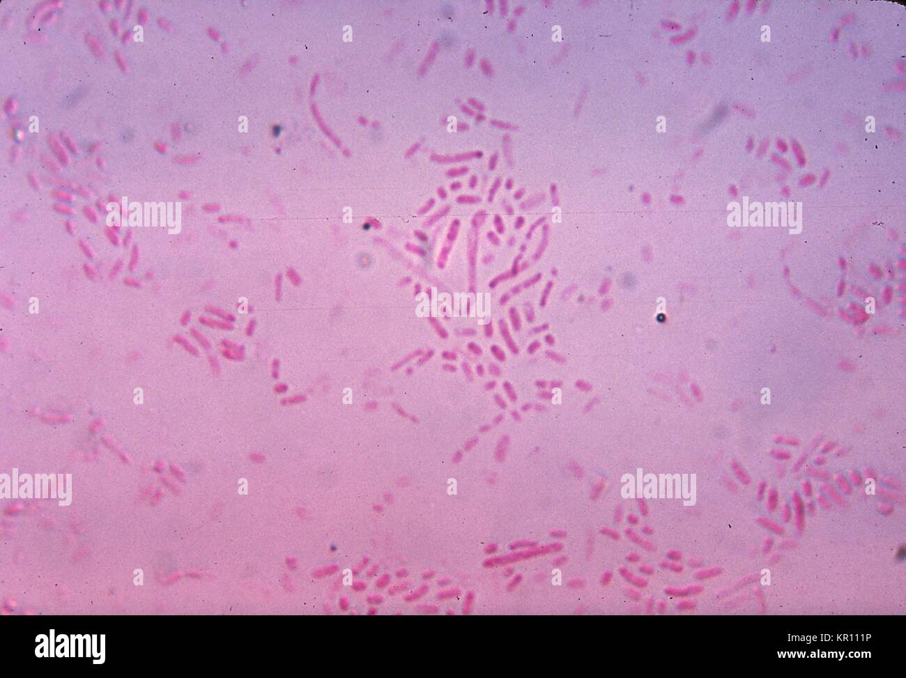 Diese photomicrograph zeigt Gram-negative Actinobacillus ureae, ehemals Pasteurella ureae Bakterien auf einem Nährboden für 24 Stunden gewachsen, 1971. Das Bakterium Actinobacillus ureae ist eine gemeinsame Einwohner des menschlichen Nasenrachenraum, und ist eine seltene Ursache der Meningitis bei geschwächten, immunsupprimierte Patienten, d. h. Beihilfen, langfristige Chemotherapie, etc. Mit freundlicher Genehmigung CDC/Dr. Robert Weber. Stockfoto
