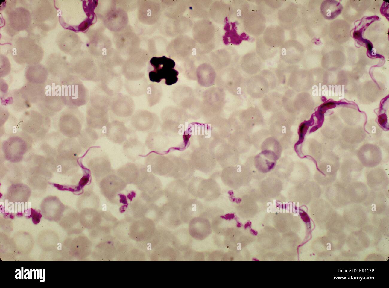 Dies ist ein schliffbild einer Ratte Blut enthüllen dem Namen Trypanosoma brucei Parasiten mit einer Giemsa Fleck Technik, 1977 bestreichen. Afrikanische Trypanosomiasis, oder?. die Schlafkrankheit?, einer schweren Infektion, die durch die protozoen dem Namen Trypanosoma brucei, ist in der Regel verteilt auf den Menschen durch die Tsetse Fliegen mit Tieren und anderen Menschen infiziert. Bild mit freundlicher Genehmigung von CDC/Dr. Mae Melvin. Stockfoto