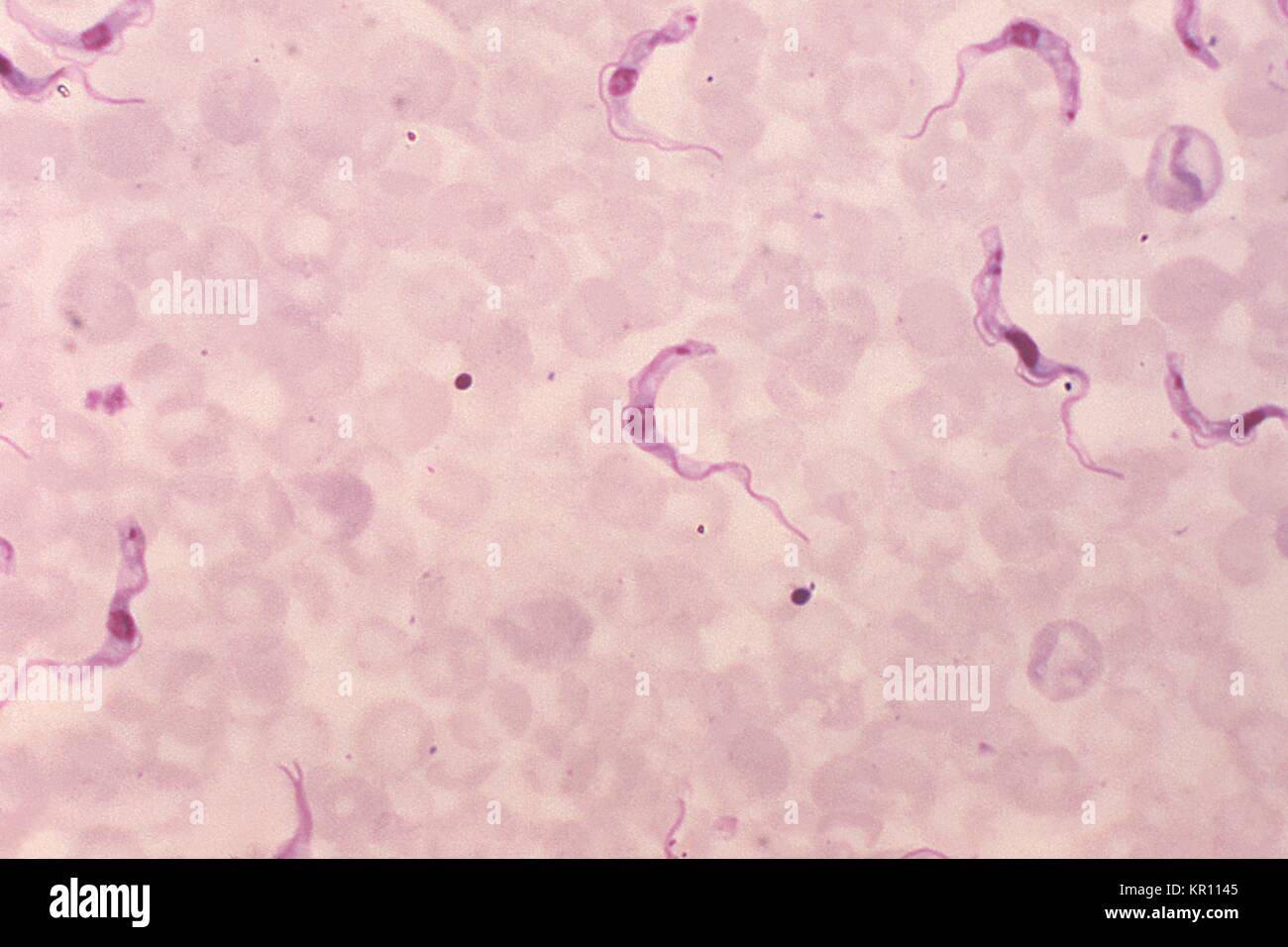 Dies ist ein schliffbild einer Ratte Blutausstrich enthüllt dem Namen Trypanosoma brucei Parasiten, mit einem giemsa Fleck Technik, 1977. Afrikanische Trypanosomiasis, oder?. die Schlafkrankheit?, einer schweren Infektion, die durch die protozoen dem Namen Trypanosoma brucei, ist in der Regel verteilt auf den Menschen durch die Tsetse Fliegen mit Tieren und anderen Menschen infiziert. Bild mit freundlicher Genehmigung von CDC/Dr. Mae Melvin. Stockfoto