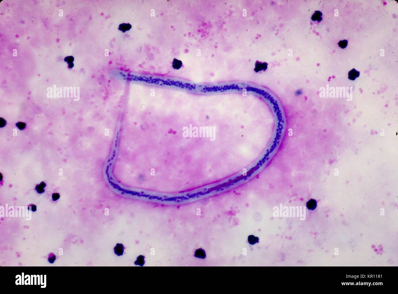 Dies ist eine Aufnahme von der internen Struktur eines mit Giemsa Wuchereria bancrofti microfilaria Fleck, 1977. W. bancrofti, der häufigsten filarial Parasit im Menschen, ist eines der Erreger, die an lymphatischer Filariose erkrankt sind. Die lymphatische Filariose wirkt sich auf schätzungsweise 120 Millionen Menschen in tropischen Gebieten der Welt. Bild mit freundlicher Genehmigung von CDC/Dr. Mae Melvin. Stockfoto