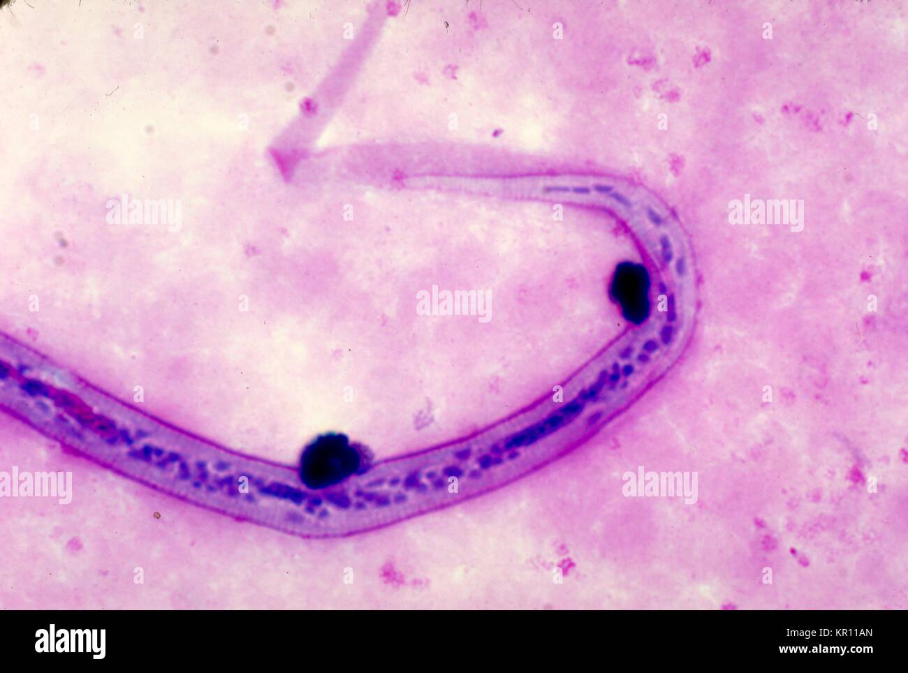 Dies ist eine Aufnahme von der posterioren Ende einer Wuchereria bancrofti microfilaria mit Giemsa Fleck, 1977 Blut verschmiert. W. bancrofti, der häufigsten filarial Parasit im Menschen, ist eines der Erreger, die an lymphatischer Filariose erkrankt sind. Die lymphatische Filariose wirkt sich auf schätzungsweise 120 Millionen Menschen in tropischen Gebieten der Welt. Bild mit freundlicher Genehmigung von CDC/Dr. Mae Melvin. Stockfoto