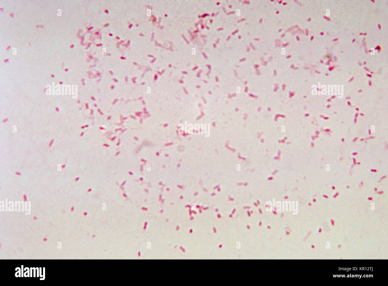 Diese photomicrograph zeigt Bacteroides fragilis ss, 1972. vulgatus nach kultivierten, in einem thioglycollate Medium für 48 Stunden. Mitglieder der Gattungen Bacteroides sind anaerobe Gram-negative Bakterien, die vor allem im Darm als normale Flora gefunden werden. Es kann jedoch opportunistische unter entsprechenden prädisponierenden Faktoren wie Immunsuppression, Gewebeschäden, Krebserkrankung, etc. Mit freundlicher Genehmigung CDC / Dr. werden V. R. Dowell, jr. Stockfoto