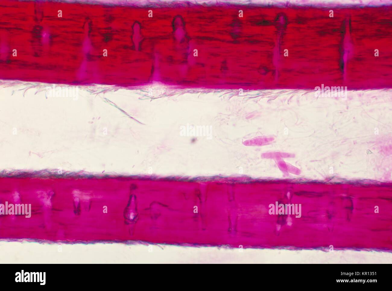 Diese photomicrograph Anzeichen von der Pilz Trichophyton mariatii während einer Haar perforation Test, 1973. Die Gattung Trichophyton bewohnt die Erde, Menschen oder Tiere, und ist eine der führenden Ursachen für Haare, Haut und Nägel Infektionen, d. h. dermatophytosis, in den Menschen. Bild mit freundlicher Genehmigung von CDC/Dr. Arvind A. Padhye. Stockfoto