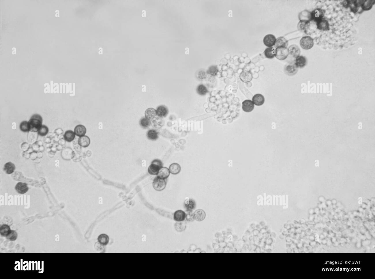 Das ist ein Bild für chlamydospores, die reproduktive, dickwandige Strukturen der Pilz Candida albicans, 1963. Chlamydospores sind eine spezielle Art von Spore, die größer sind als die standard Sporen durch die besonderen Pilz produziert und haben sehr dicke Wände. Chlamydospores sind in der Regel dunkel pigmentiert. Bild mit freundlicher Genehmigung von CDC/Dr. Gordon Roberstad. Stockfoto