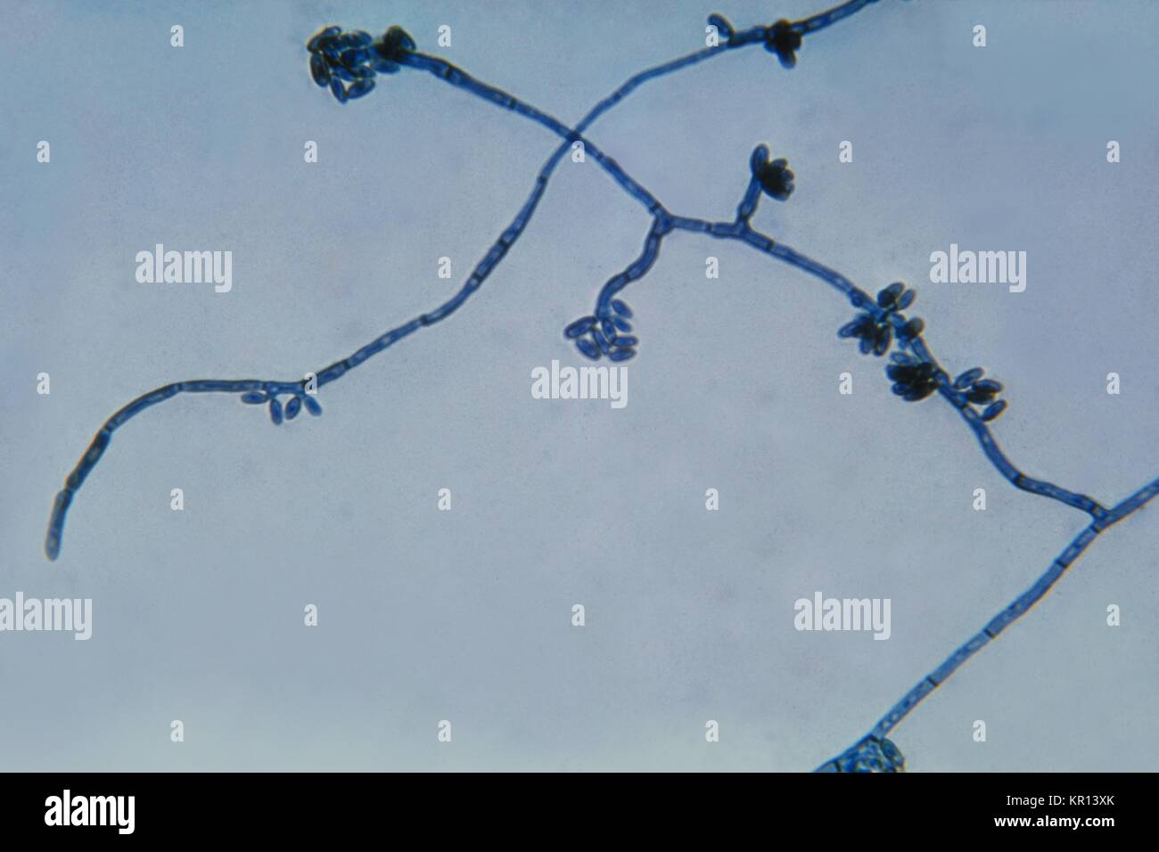 Dies ist ein photomicrograph des Pilzes Hortaea werneckii, der Erreger der Tinea Nigra, 1964. Tinea Nigra ist ein oberflächliches, asymptomatische Pilzinfektion des Stratum corneum der Haut und wird durch die schwarze Flecken auf den Handflächen oder Fußsohlen geprägt. Der Pilz lebt auf Pflanzen, Boden und Nahrungsmittel mit einem hohen Salzgehalt. Bild mit freundlicher Genehmigung von CDC/Dr. Lucille K. Georg. Stockfoto