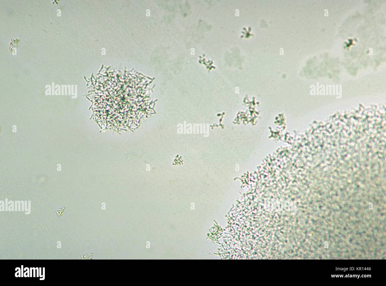 Diese photomicrograph schildert Corynebacterium matruchotii Kolonien kultivierten in BHIA von Tag 3, 1970. Mitglieder der Gattung Corynebacterium sind gram-positive Bakterien, die gerade oder leicht gekrümmte Stäbe sind mit häufigen Club-förmige Schwellungen. Mit freundlicher CDC. Stockfoto