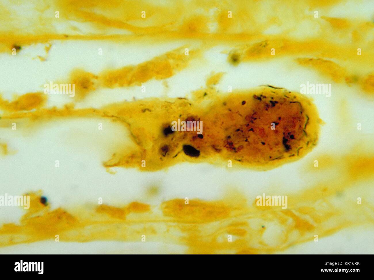Photomicrograph von nierengewebe, mit einer silberfärbung Technik