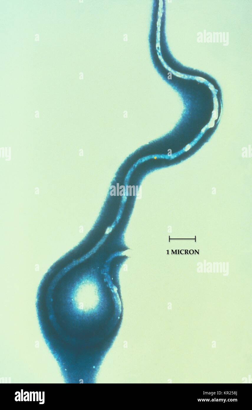 Photomicrograph von Borrelia burgdorferi, das Bakterium, das die Lyme Krankheit verursachen. Dies ist eine spiralförmige Bakterium, das häufig durch Rotwild Zecken der Gattung Ixodes, 1975 durchgeführt wird. Wenn der Hirsch Zeckenbisse ein menschliches Wesen, die Bakterien in den menschlichen Blutkreislauf übertragen. Mit freundlicher CDC. Stockfoto