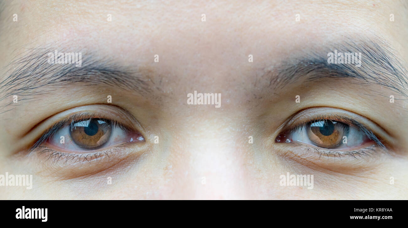 Makroaufnahme der asiatischen Frau mittleren Alters braune Augen mit Falten  unter den Augen und Venen in die Augen. Augenlid Problem benötigen  Chirurgie für Anheben Stockfotografie - Alamy