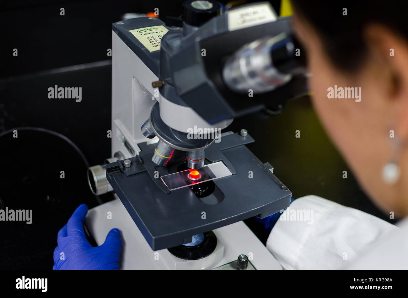 Prüfung von Blut Folie unter dem Mikroskop Stockfoto