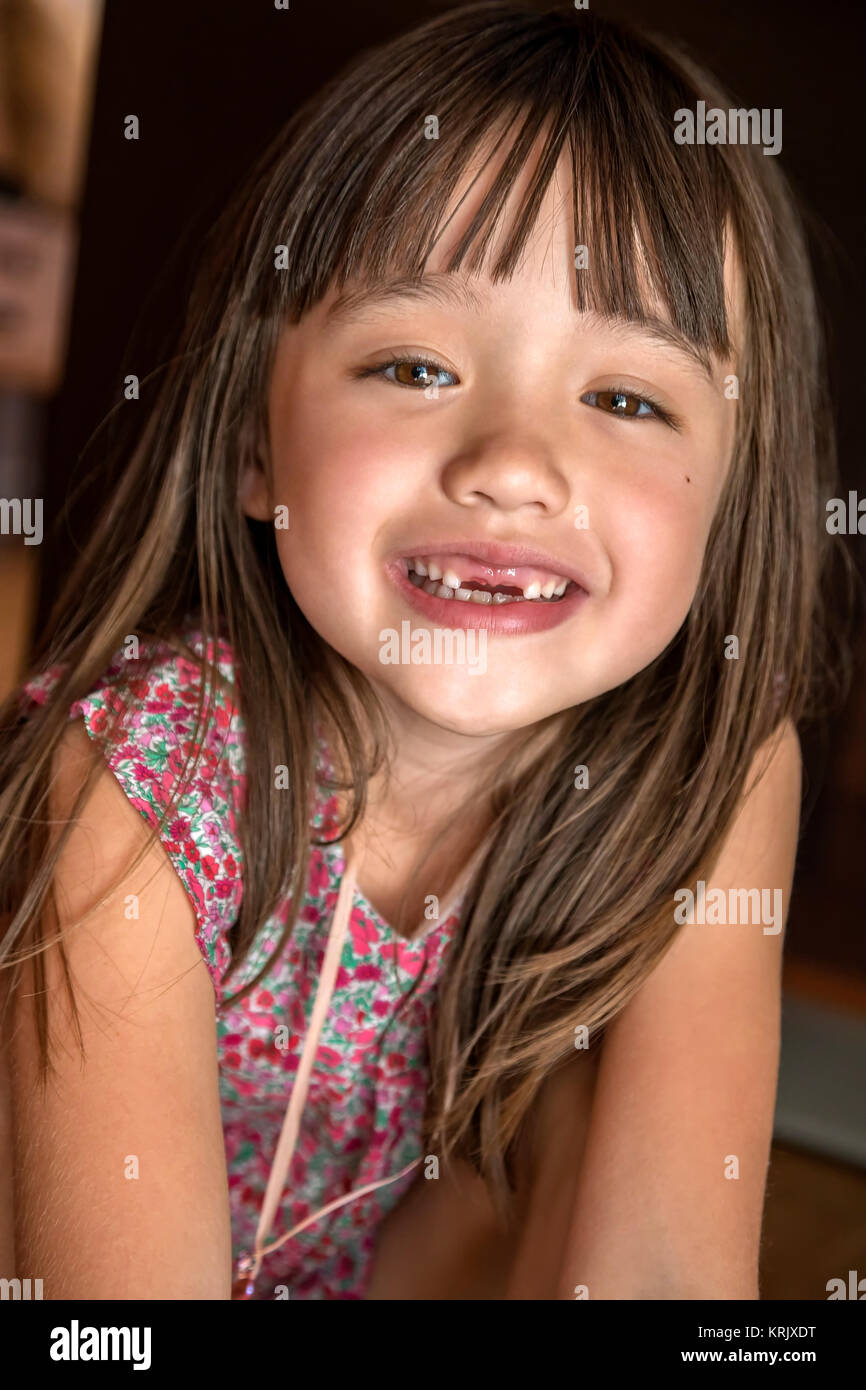 Fünf Jahre altes Mädchen fehlen ihr ihre zwei vorderen Zähne Stockfoto