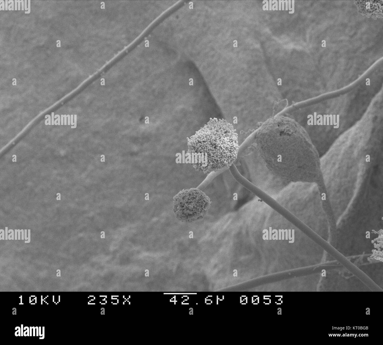 Aspergillus ist eine Gattung von Pilzen, die häufig in Umweltumgebungen vorkommen, insbesondere in Böden und verfallendem organischen Material. Bestimmte Arten wie Aspergillus flavus produzieren Mykotoxine, die sowohl die menschliche Gesundheit als auch landwirtschaftliche Erzeugnisse beeinträchtigen können. Stockfoto