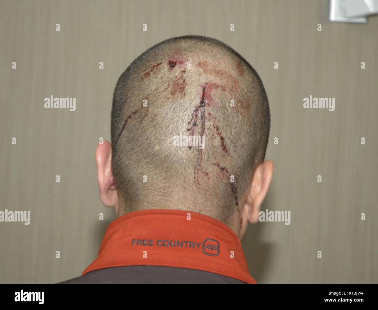 Dieses Bild zeigt George Zimmermans Kopf von hinten. Zimmerman wurde weithin bekannt, weil er an der Erschießung von Trayvon Martin beteiligt war, ein Fall, der nationale Diskussionen über Rasse, Gerechtigkeit und Waffengesetze in den Vereinigten Staaten auslöste. Stockfoto