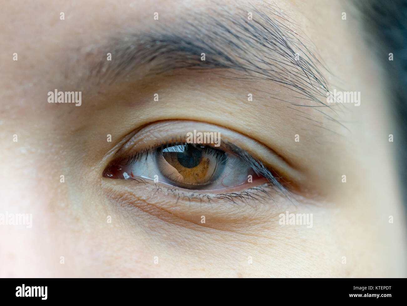 Augenlidoperation Stockfotos Und Bilder Kaufen Alamy