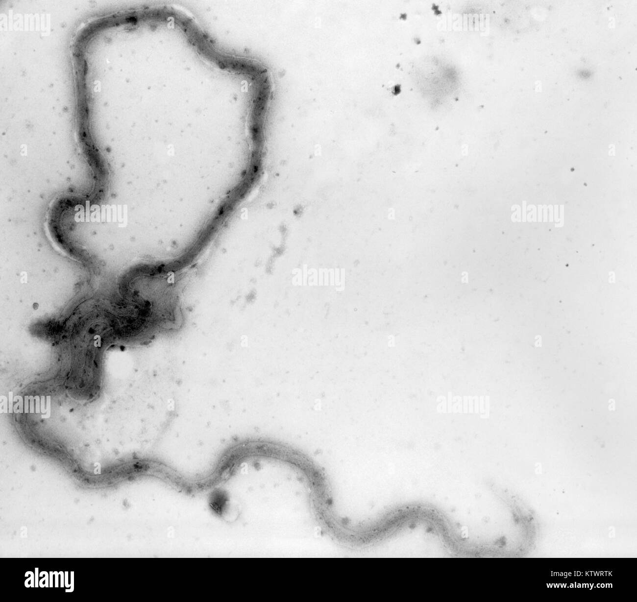 Eine photomicrograph eines Treponema pallidum Bakterium. Eine photomicrograph einen ganzen Berg von Virulenten T. pallidum, 1970. Dieser mikroskopische Bakterium (spirochäte) ist ein Wurm - wie spiralförmige Organismus, die kräftig wackelt, wenn unter dem Mikroskop betrachtet. Mit freundlicher CDC, VDRL-Abteilung. Stockfoto