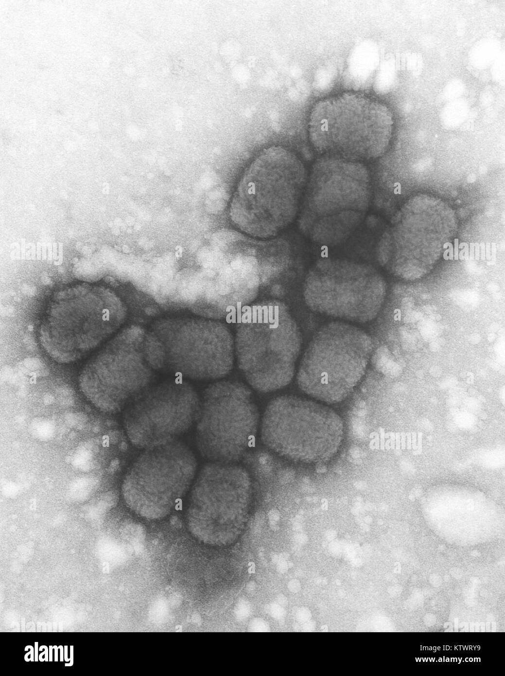 Eine Transmission Electron Micrograph (TEM) von Pockenviren über einen negativen Fleck Technik, 1975. Sie PHIL 10144 für Eine eingefärbte Version dieses schwarz-weiß-Bild. Pocken ist eine gefährliche, hochansteckende, und manchmal tödliche Infektionskrankheit. Es gibt keine spezifische Behandlung für Pocken die Krankheit, und der einzige Vorbeugung ist die Impfung. Bild mit freundlicher Genehmigung von CDC/Dr. Fred Murphy. Stockfoto