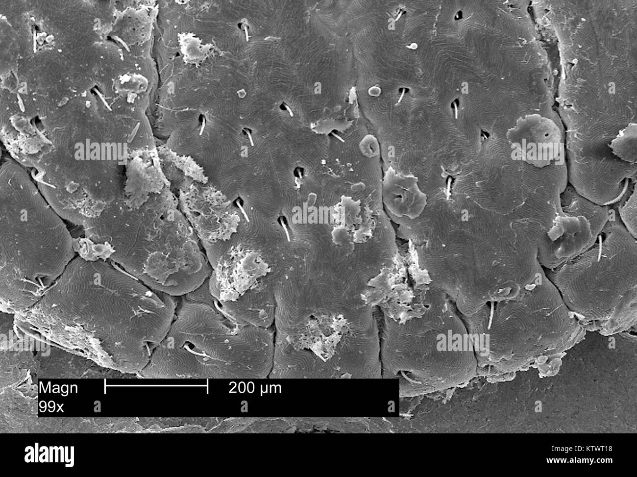 Diese Scanning Electron Micrograph (SEM) zeigt eine Dorsale Ansicht der Scutum, einer American dog Tick, Dermacentor variabilis, vergrößerte 99 X. Zecken sind der Klasse Spinnen, Spinnen und Milben, 2002. D. variabilis ist ein bekannter Anbieter von Rocky Mountain Spotted Fever, verursacht durch das Bakterium Rickettsien rickettsii. Mit freundlicher CDC. Stockfoto