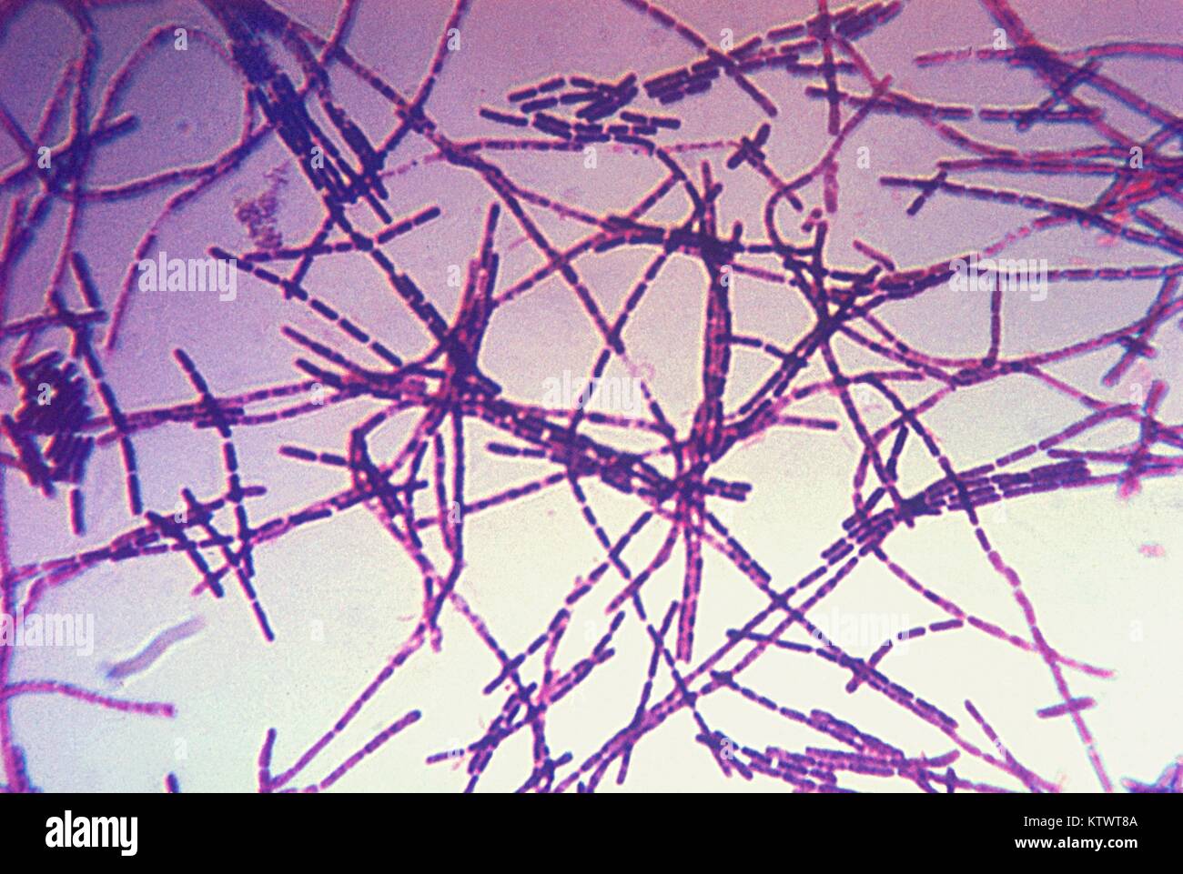 Eine photomicrograph von Bacillus anthracis Bakterien mit Gram-Fleck-Technik. Anthrax ist bestimmt durch die Isolierung von B. anthracis aus dem Blut, Hautverletzungen, oder respiratorische Sekrete, oder durch Messung der spezifischen Antikörper im Blut von Personen mit Verdacht auf. Mit freundlicher CDC. 1975. Stockfoto