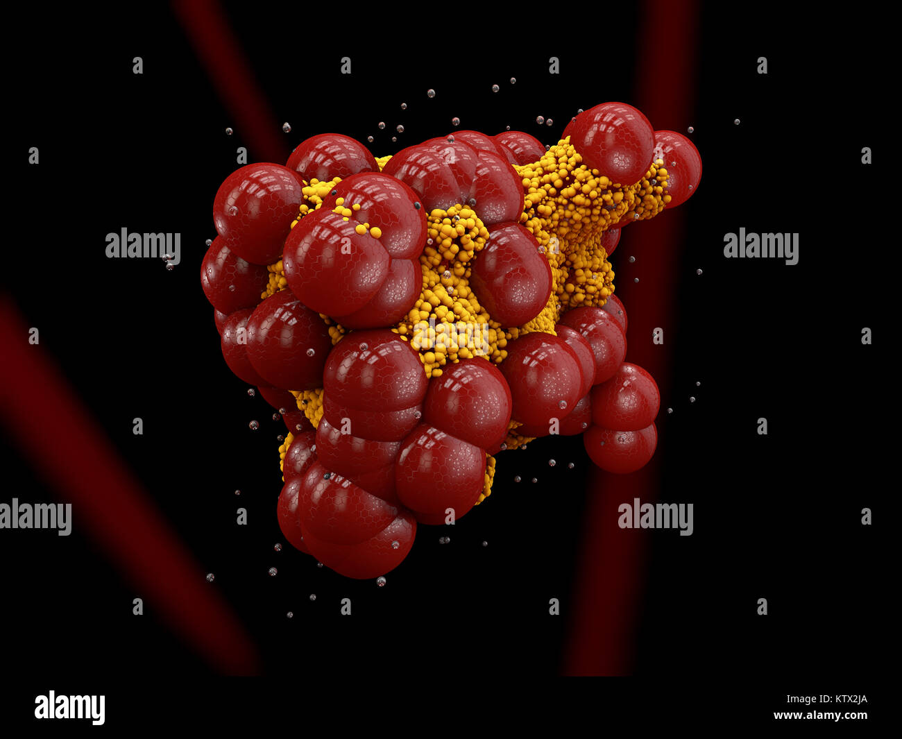 Arteriosklerose und atherotrombosis. Auf schwarz, 3DIllustration