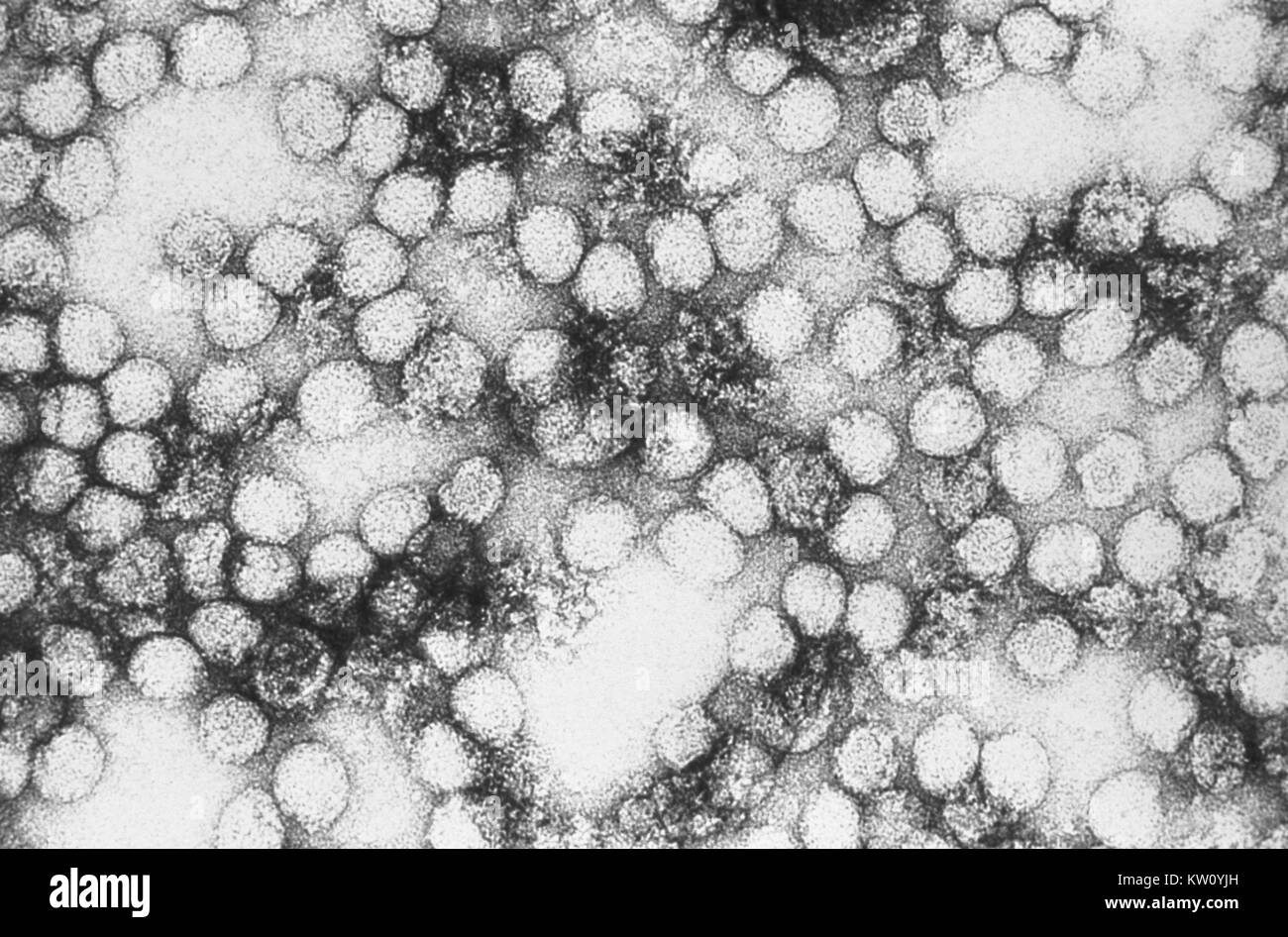 Eine Transmission Electron Micrograph (TEM) von Gelbfieber virus Virionen. Virionen sind kugelförmige, einheitlich in Form und sind mit einem Durchmesser von 40-60 Nm. Der Name "Gelbfieber" ist aufgrund der daraus resultierenden Gelbsucht, die bei einigen Patienten. Der Vektor ist die Aedes aegypti, oder Haemagogus spp. Moskito. Mit freundlicher CDC/Erskine Palmer, 1981. Stockfoto