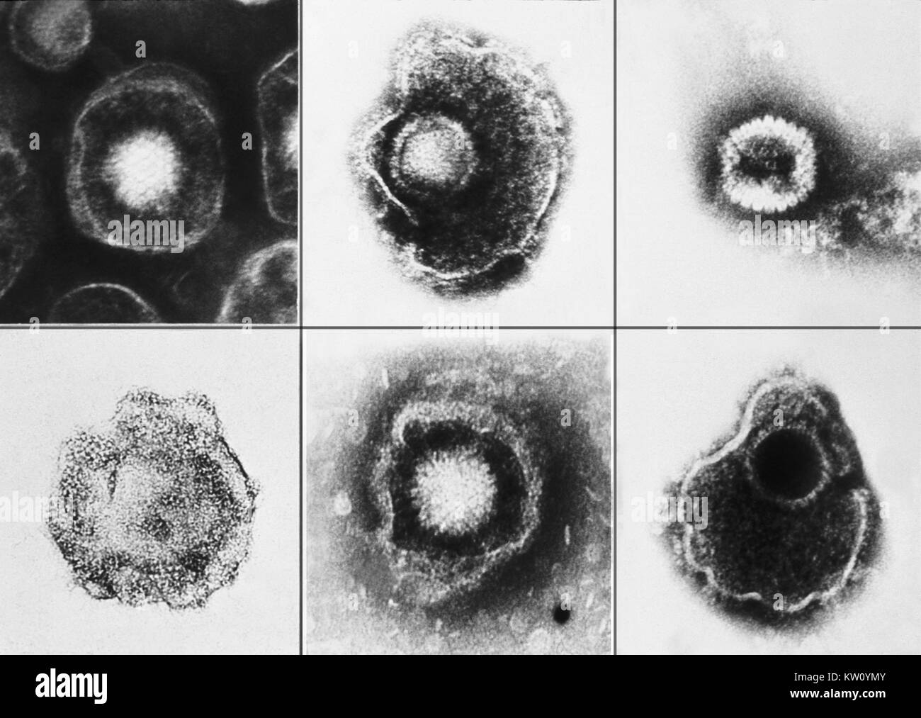 Verschiedene Viren aus der Familie Herpesviridae mit einem Elektronenmikroskop gesehen. Unter diesen Mitgliedern ist Varicella-zoster-(Windpocken), Herpes simplex Typ 1 und Typ 2 (HSV-1, HSV-2). Bild mit freundlicher Genehmigung von CDC/Dr. Erskine Palmer, 1981. Stockfoto