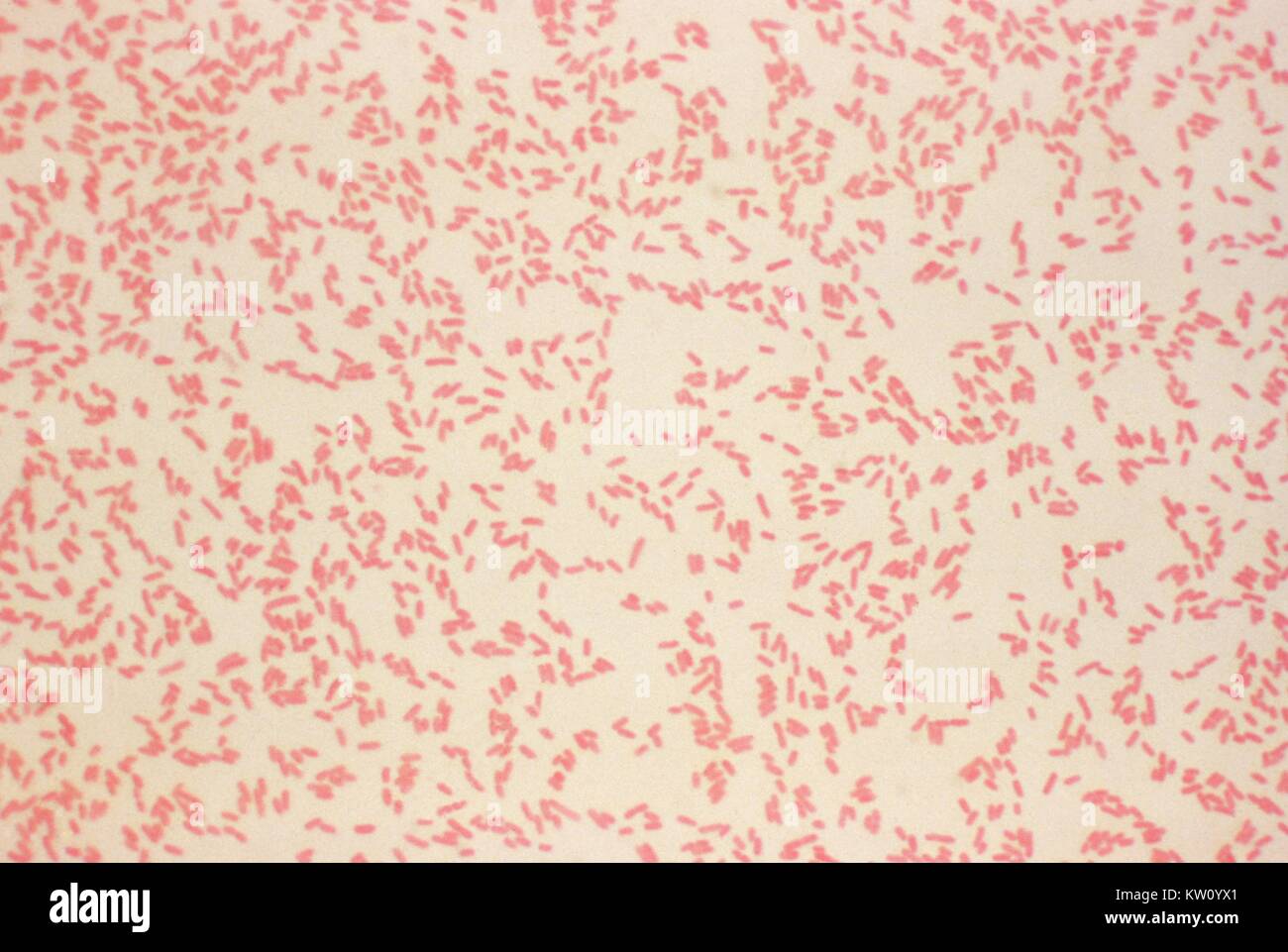 Eine photomicrograph von Yersinia enterocolitica-Fleck mit Gramm ...