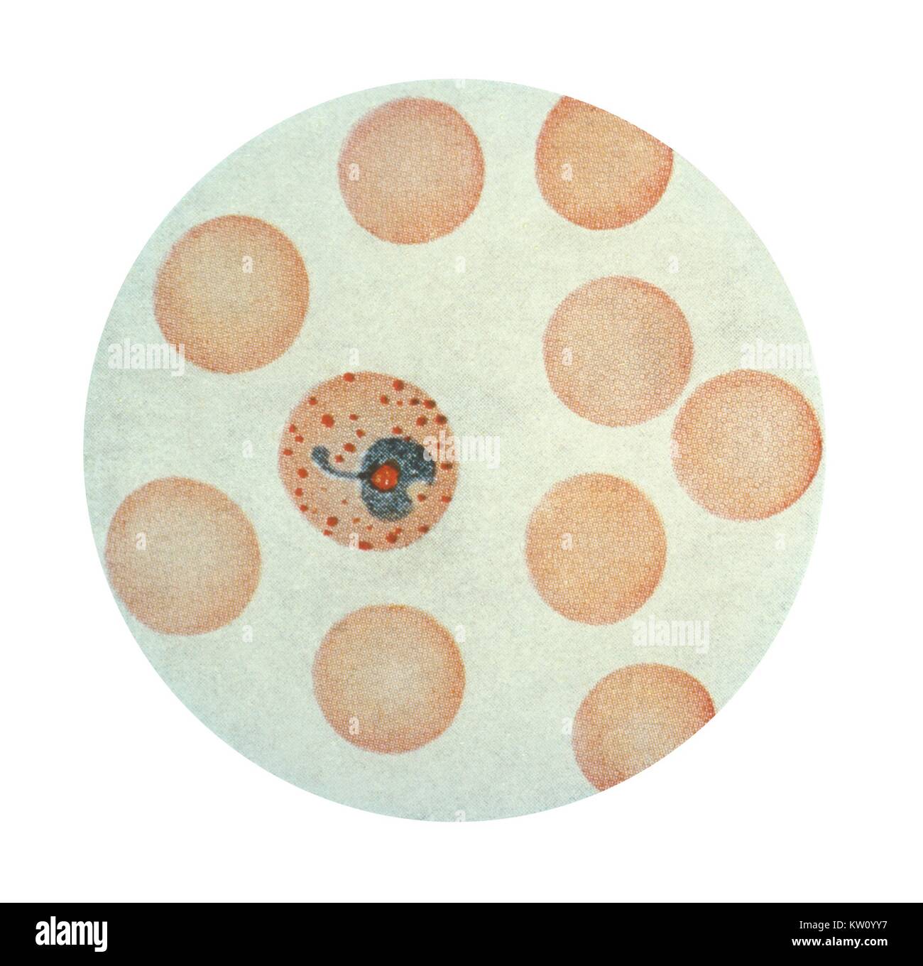 Eine photomicrograph Plasmodium vivax in seiner Anti-erythrozyten trophozoite Bühne, über Wrights Fleck. x 1500. Diese erythrozyten verfügt über einen ausgereiften trophozoite geworden, die in ein schizont im Anti-erythrozyten Zyklus des Malariaparasiten entwickeln. Hinweis Der erweiterten Stand der Erythrozyten mit zahlreichen Shuffner punkten. Mit freundlicher Genehmigung der CDC, 1979. Stockfoto