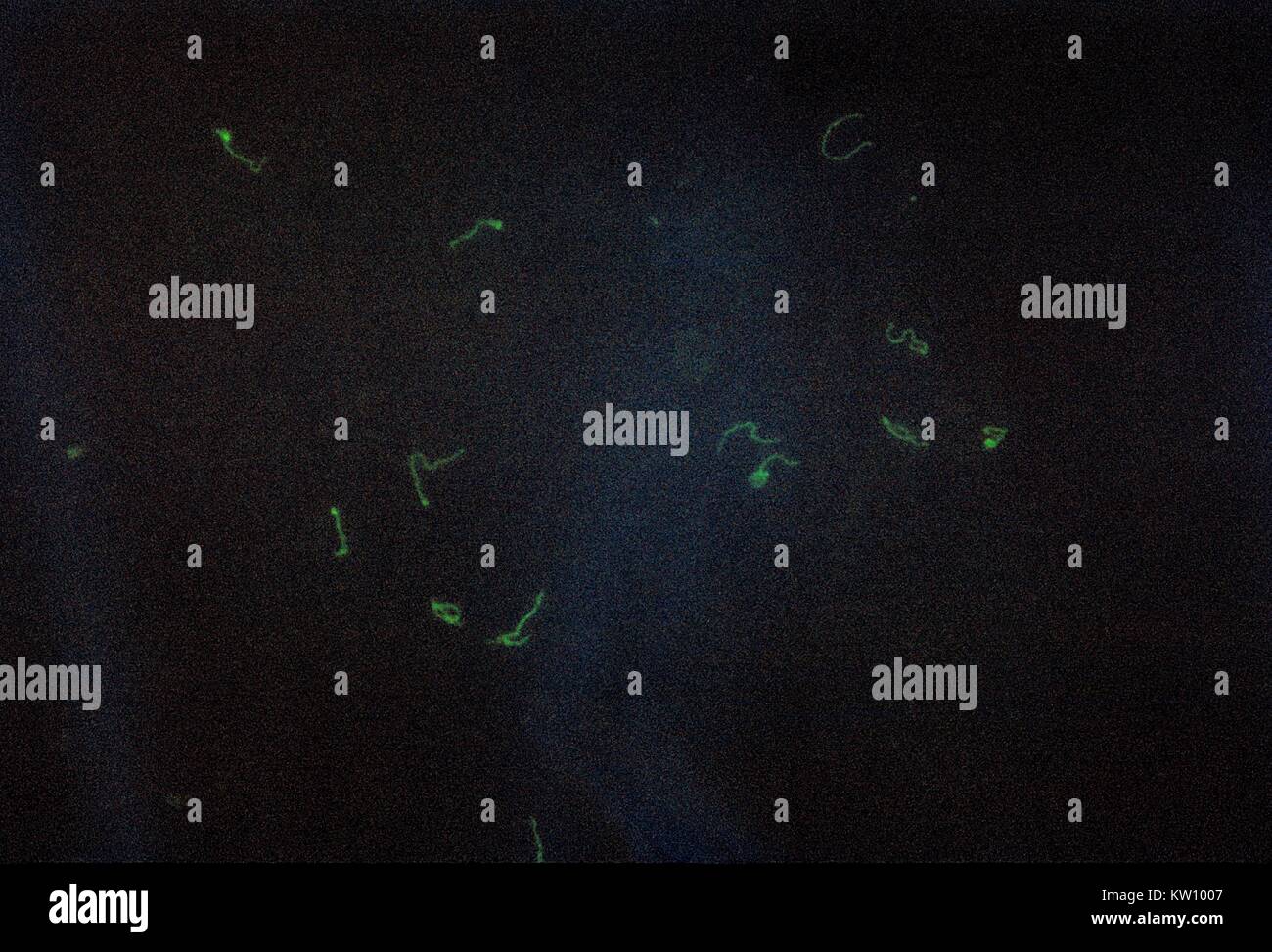 Treponema pallidum, IFA Fleck für Fluoreszenz Treponema Antikörper (FTA) Antigen. Eine Blutprobe kann erkennen das Vorhandensein der Antikörper produziert, die von einem infizierten Patienten durch verbindliche Chemikalien auf die Antikörper, die fluoreszieren unter UV-Licht grün. Mit freundlicher Genehmigung der CDC, 1970. Stockfoto