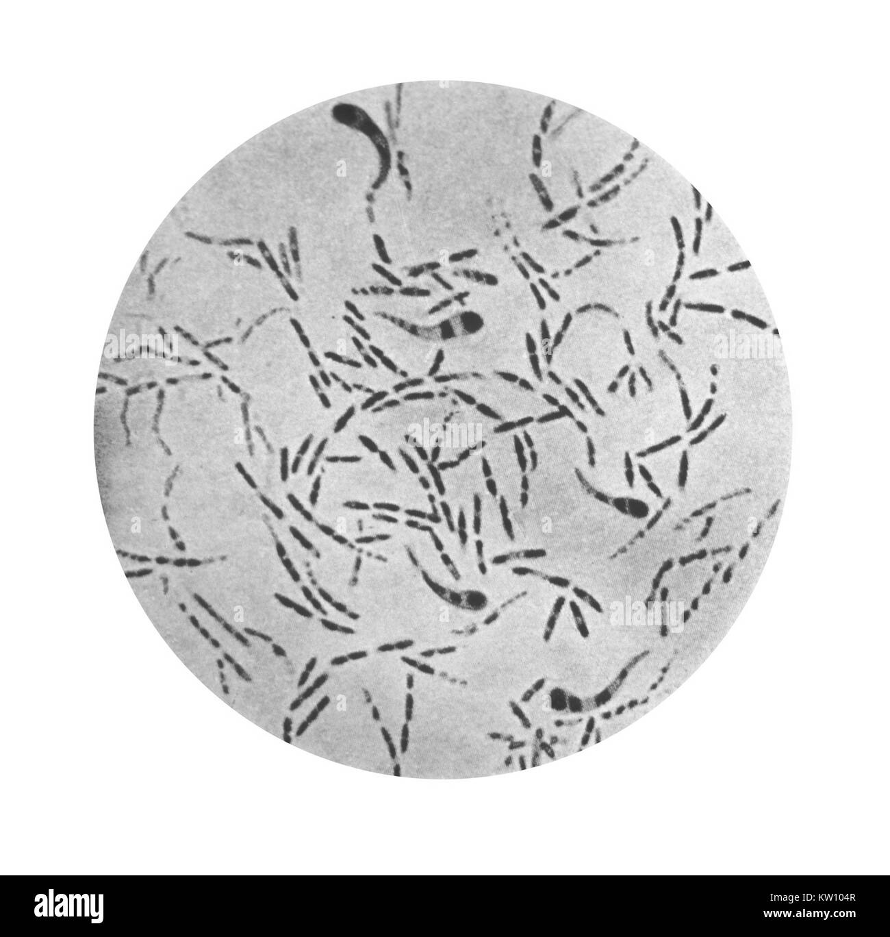 In dieser Abbildung wird eine photomicrographic Ansicht von Corynebacterium diphtheriae- Bakterien mit einem Gram-Fleck-Technik. Corynebacterium diphtheriae- ursachen Diphtherie-, dass die oberen Atemwege, wo eine entzündliche Exsudat verursacht schwere Behinderung der Atmung Atemwege betrifft, und in manchen Fällen auch Ersticken verursachen kann. Mit freundlicher Genehmigung der CDC, 1979. Stockfoto
