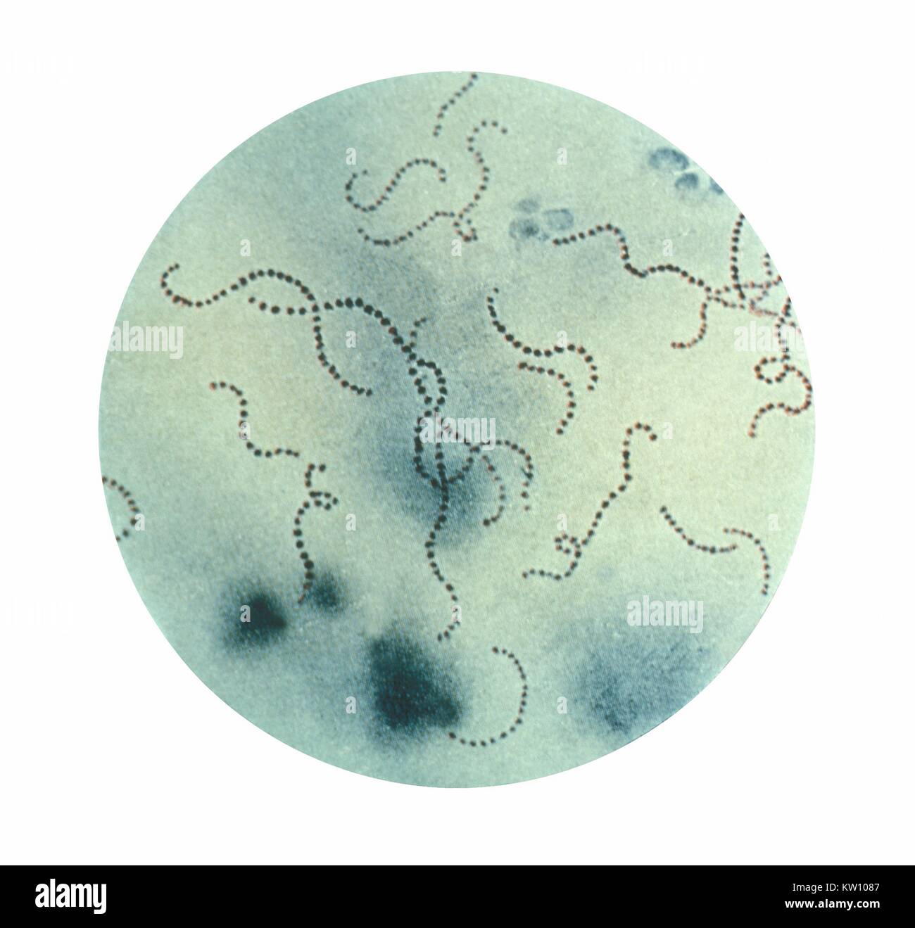 In dieser Abbildung wird eine photomicrographic Ansicht von Streptococcus pyogenes Bakterien. Im letzten Jahrhundert, Infektionen durch Streptococcus pyogenes, (S. hemolyticus), behauptete viele Leben, vor allem, da der Organismus die wichtigste Ursache war der Kindbettfieber und Scharlach. Streptokokken. Mit freundlicher Genehmigung der CDC, 1979. Stockfoto
