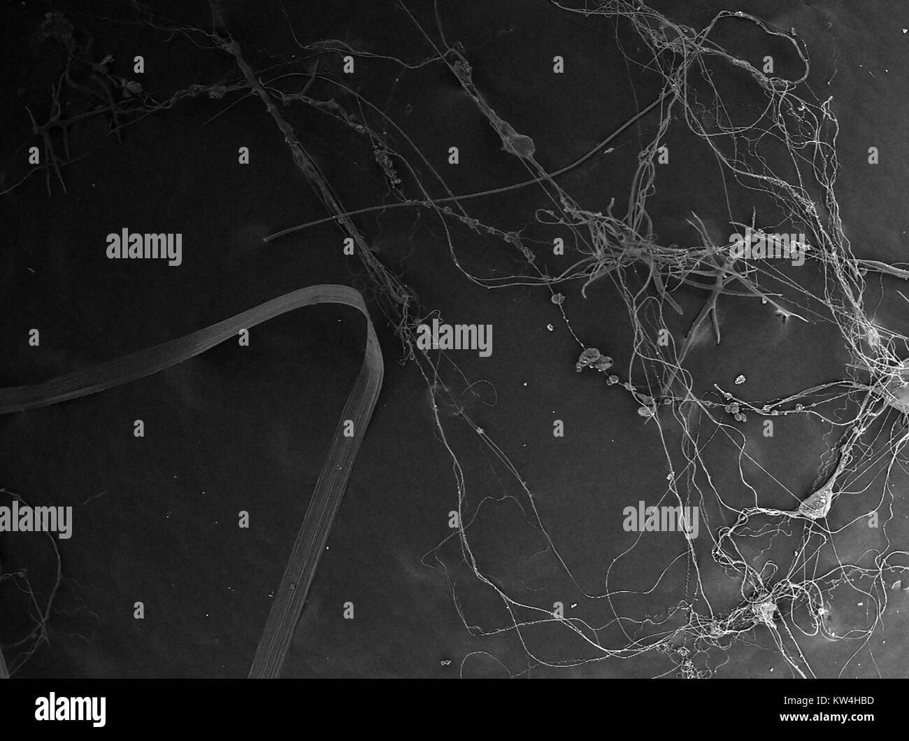 Rasterelektronenmikroskop (REM) Aufnahme, die Spinnenseide, einschließlich Gewinde, hydrogel und nano-fibrille Seide Arten, bei einer Vergrößerung von 80x, 2016. Stockfoto