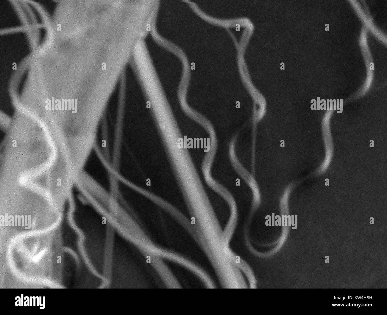 Rasterelektronenmikroskop (REM) Aufnahme, die Spinnenseide, bei einer Vergrößerung von 5000x 2016. Stockfoto