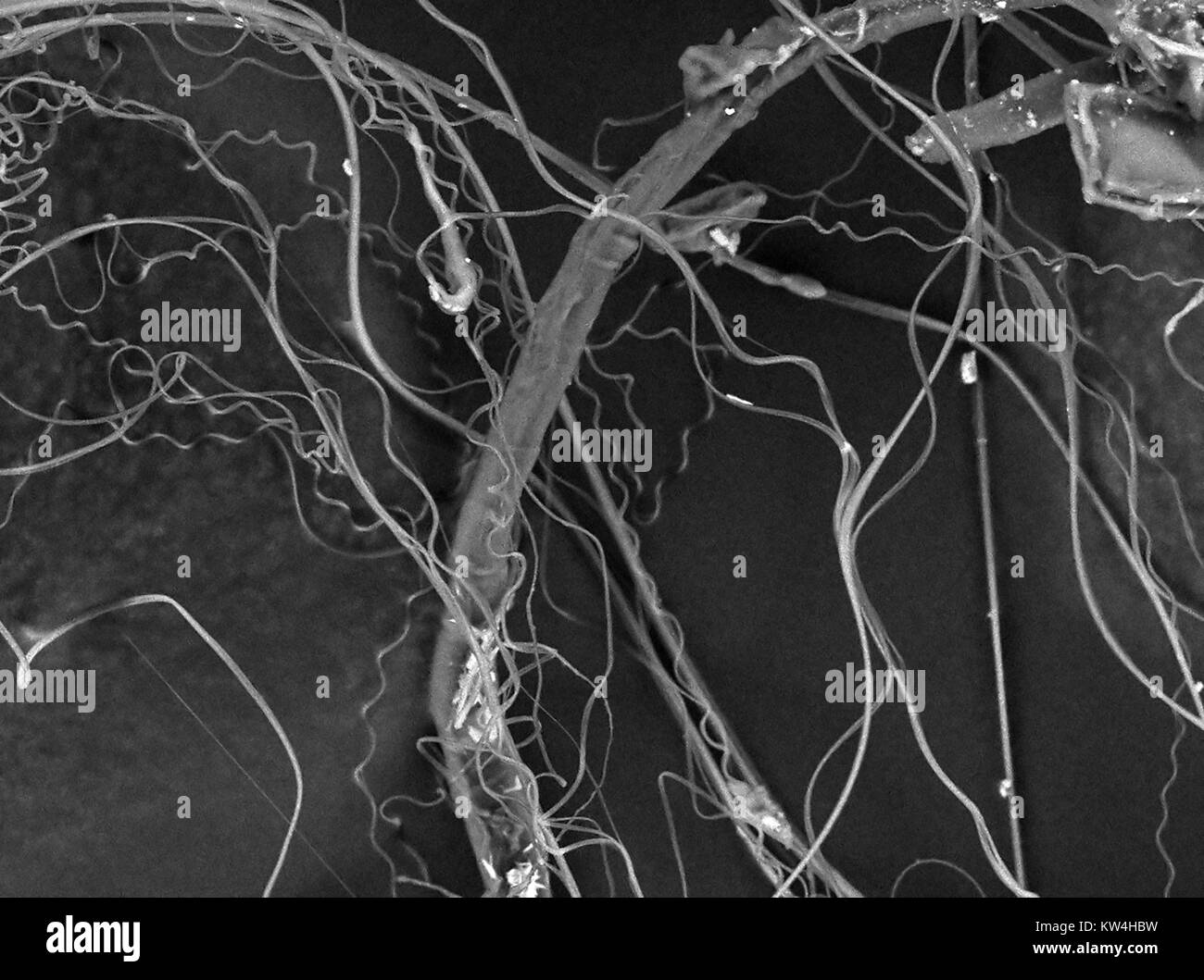 Rasterelektronenmikroskop (REM) Aufnahme, die Spinnenseide, bei einer Vergrößerung von 1500 x 2016. Stockfoto