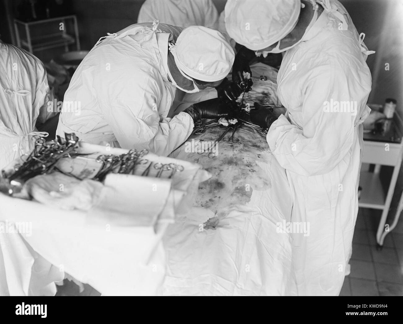 Die Teilnahme an Chirurgen lehnt sich eng über Abdomen des Patienten zu arbeiten. Das OP-Feld ist mit Blut befleckt. 1922 in einem Krankenhaus in Washington, D.C. (BSLOC 2016 10 36) Stockfoto