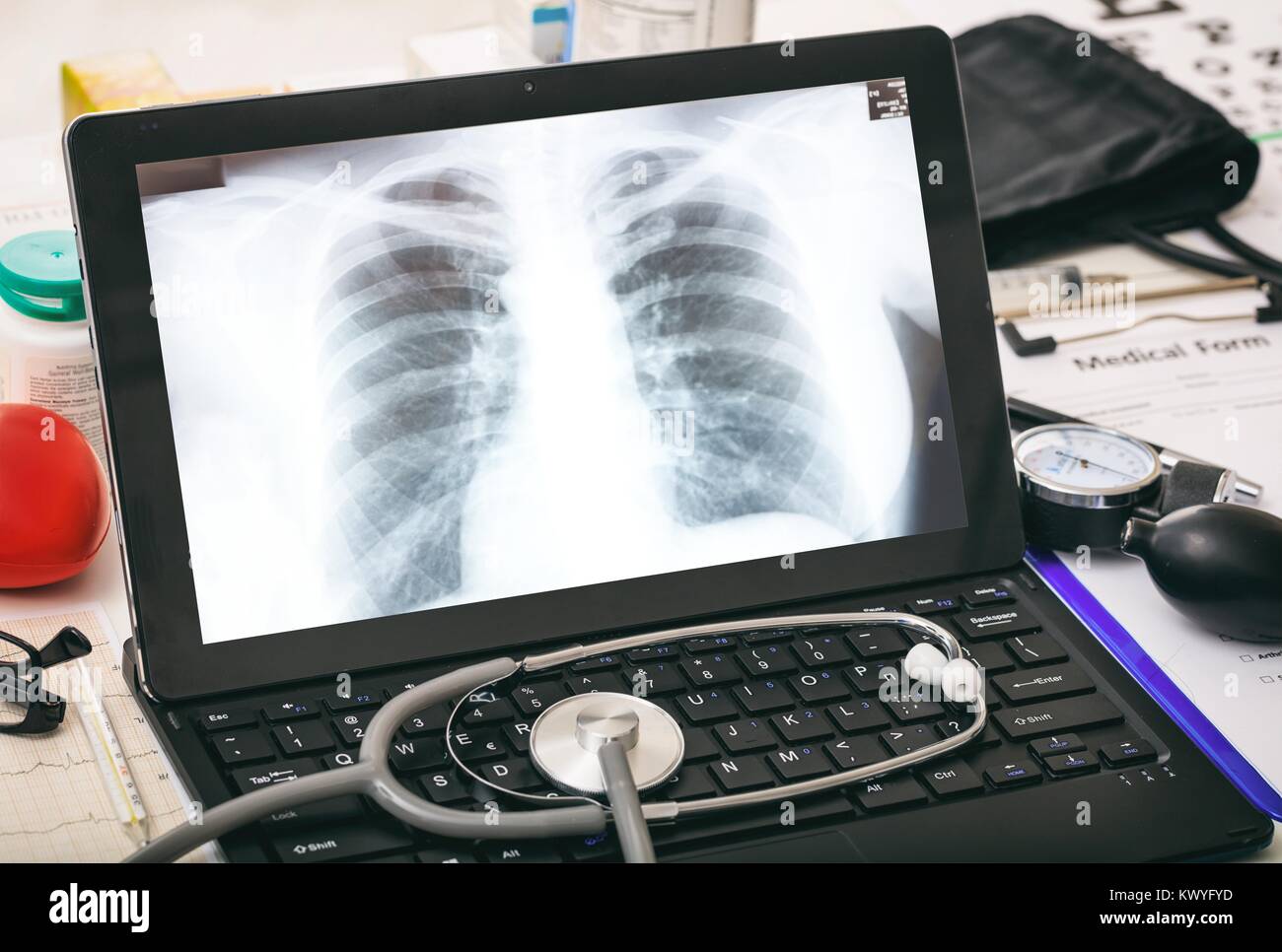 Chest X-Ray auf dem Bildschirm von einem Computer auf einem Schreibtisch Stockfoto