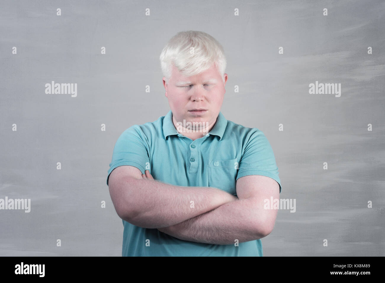 Albino junger Mann portrait. Blonde Kerl mit grauem Hintergrund isoliert. Albinismus Stockfoto