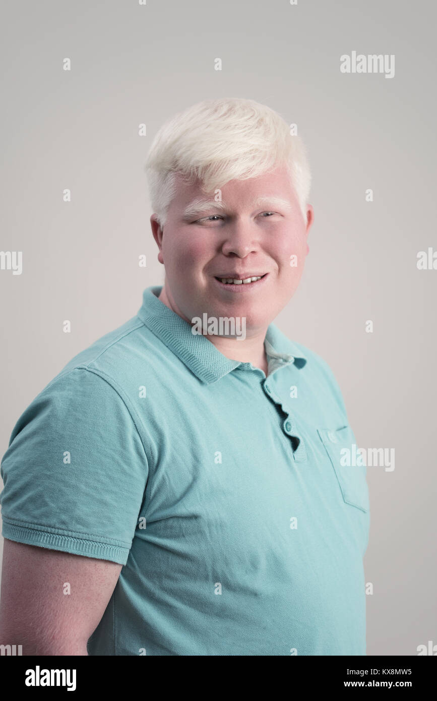 Albino junger Mann portrait. Blonde Kerl mit grauem Hintergrund isoliert. Albinismus Stockfoto