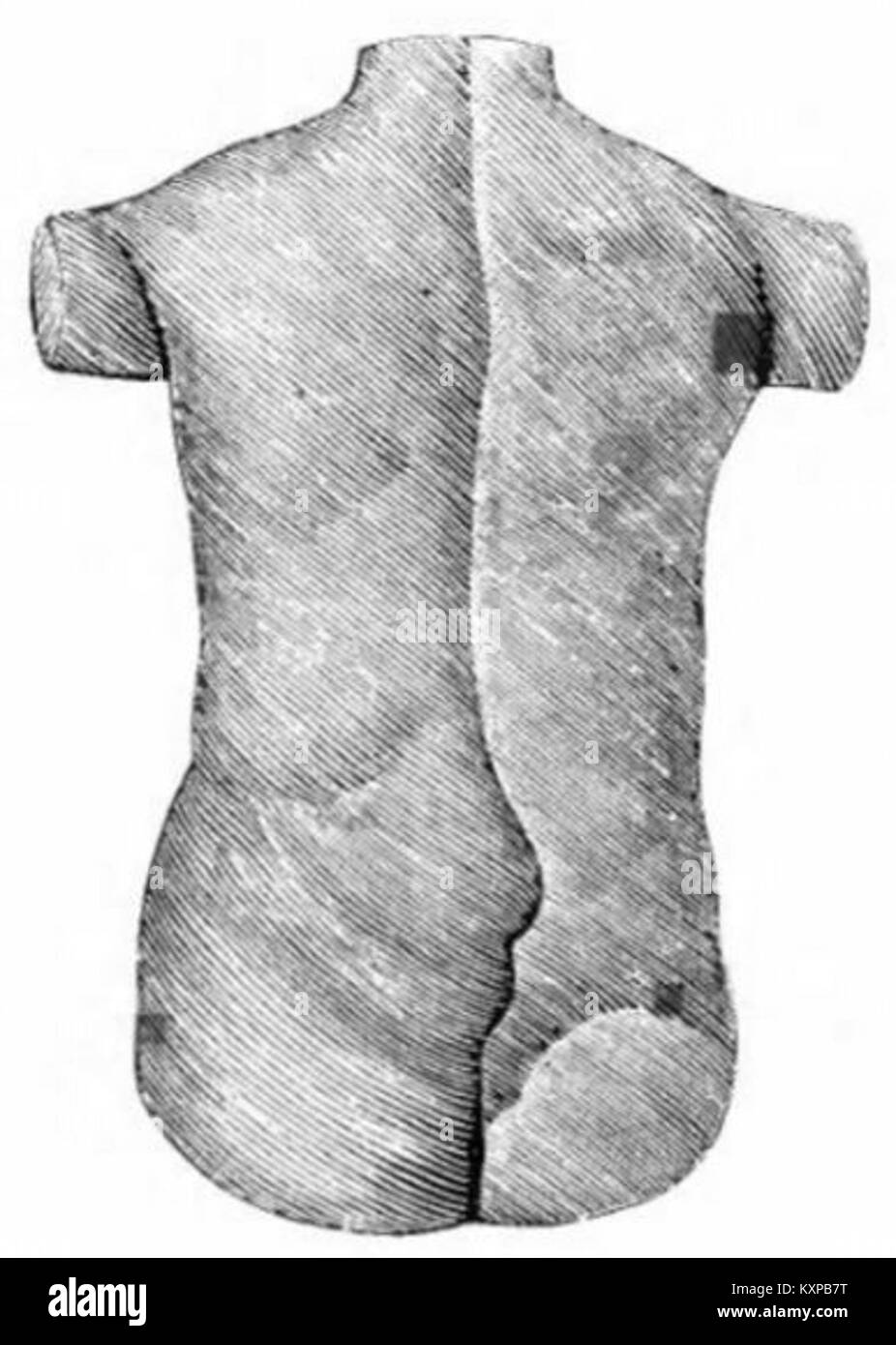 Seite aus dem Korsettenkatalog Rainal Frères, Abb. 176, zeigt Korsettenkonstruktion und Stil der französischen Mode des frühen 20. Jahrhunderts. Stockfoto