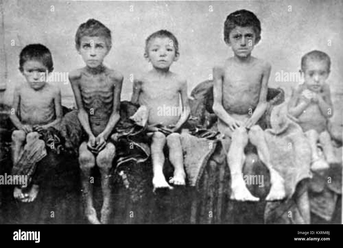 Dieses Bild zeigt Kinder, die 1922 in Berdjansk, Ukraine, von Hungersnot betroffen waren, und zeigt die menschlichen Auswirkungen der verheerenden Hungersnot während des russischen Bürgerkriegs. Das Foto dient als ergreifende Erinnerung an den Tribut des Krieges und der Naturkatastrophe an unschuldige Bevölkerungsgruppen. Stockfoto