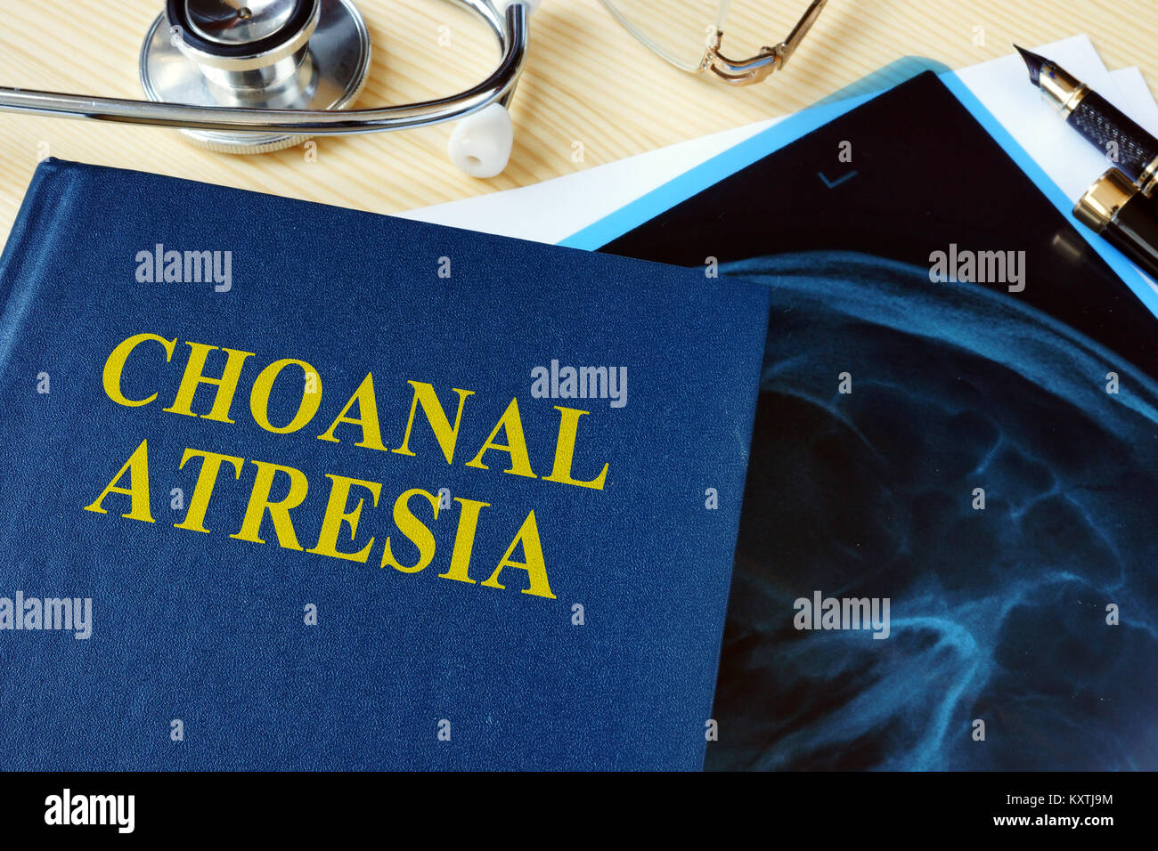 Buch über Choanal Atresia in einem Krankenhaus. Stockfoto