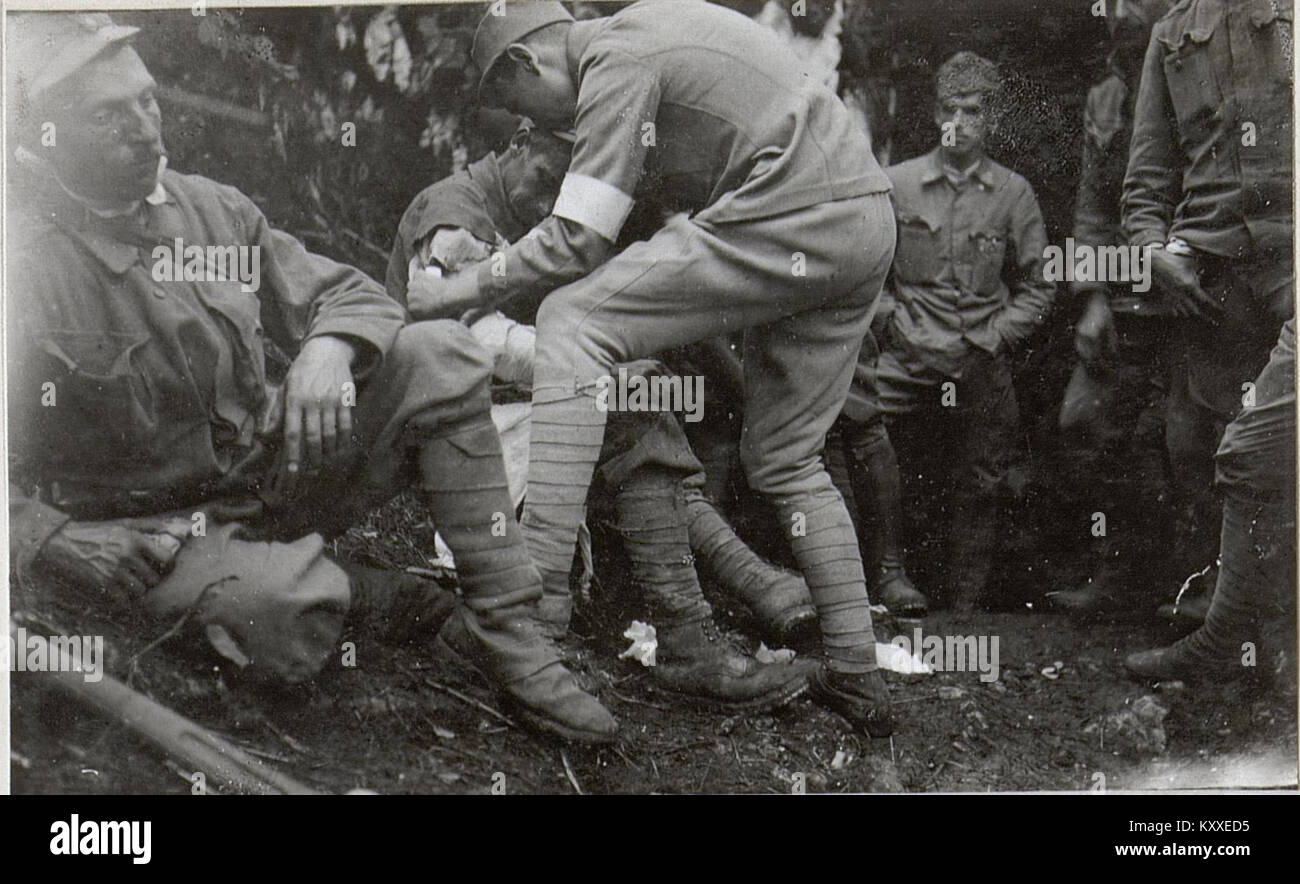 Dieses Bild zeigt erste Hilfe an verwundete Personen auf dem Lom-Plateau und dokumentiert die medizinische Hilfe, die in einem historischen Konflikt oder in einer Notsituation geleistet wird. Stockfoto