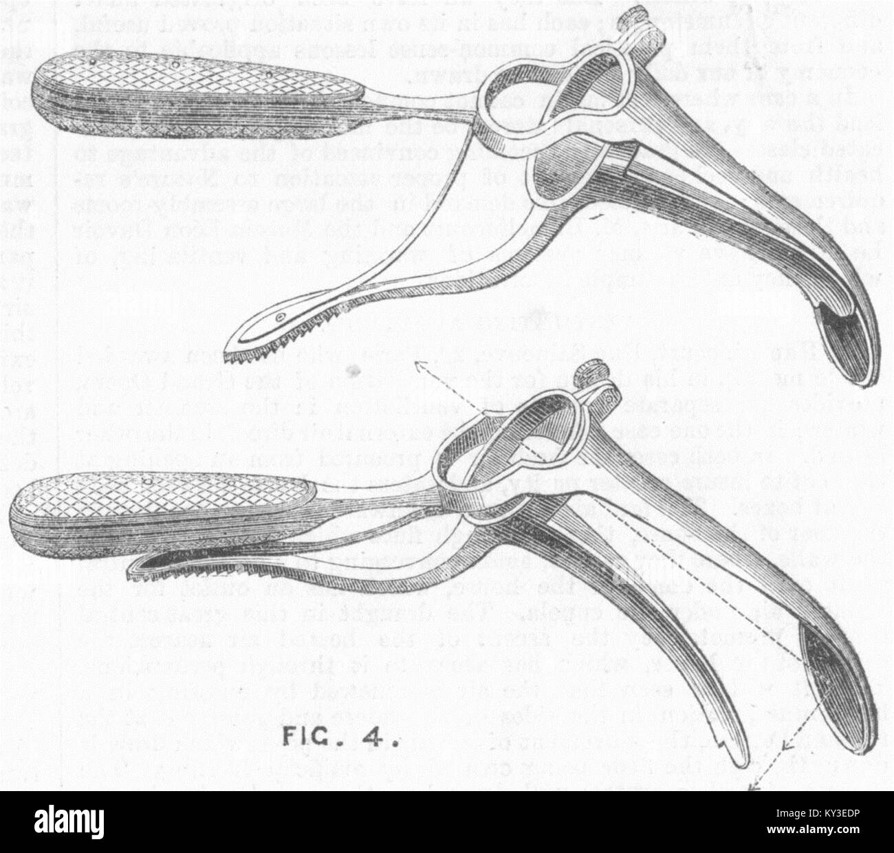 Chirurgie Instrumente Speculum zu Kehlkopf 1867 erhalten. Illustrated London News Stockfoto