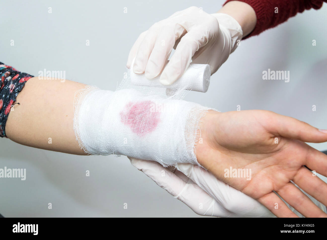Bandagieren eine blutende Verletzung am Unterarm mit einem weißen Binde Stockfoto