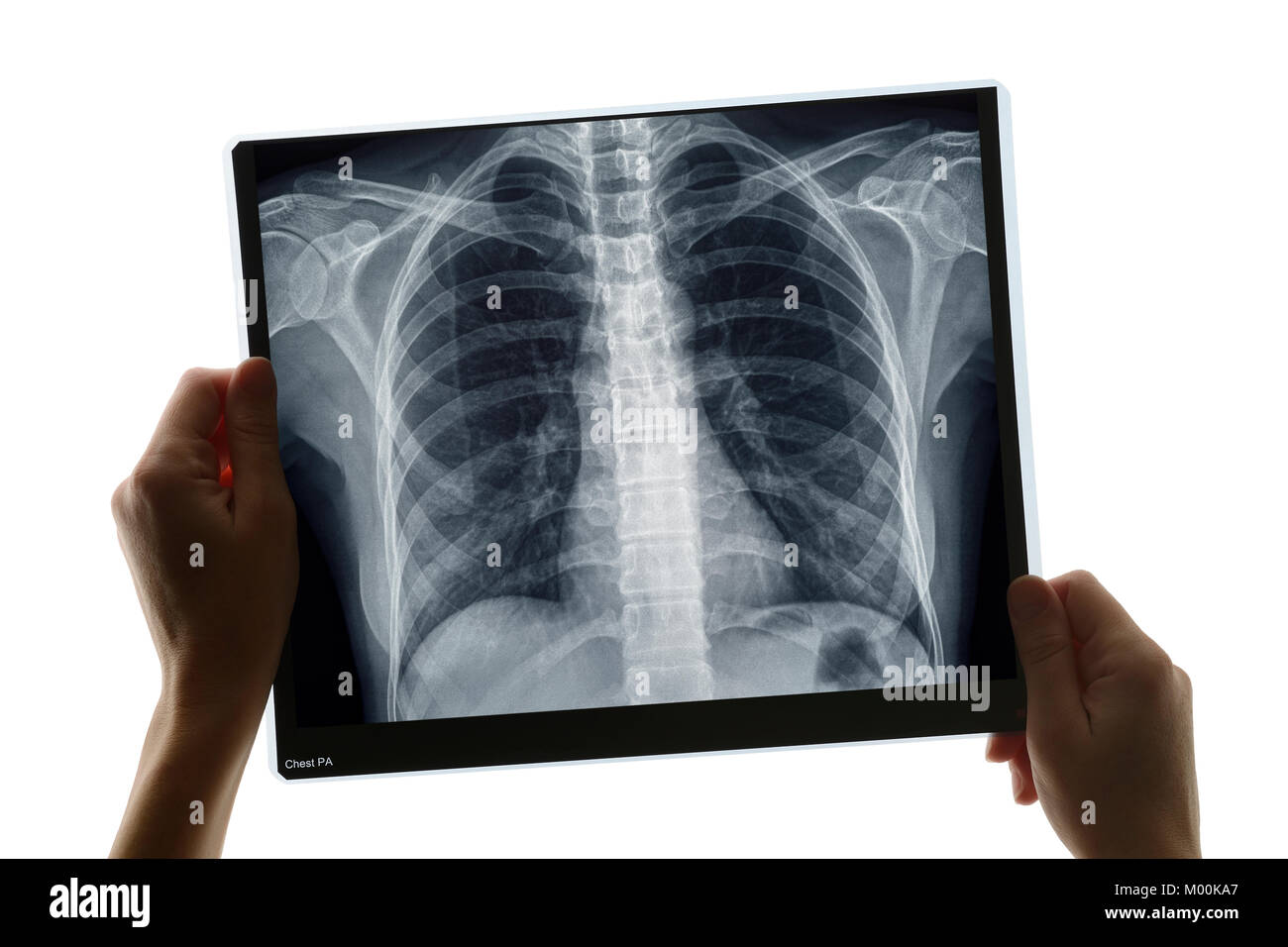 Prüfung einer Röntgenaufnahme des Thorax Stockfoto