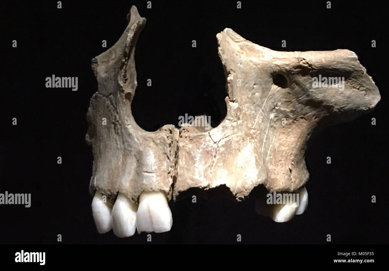 Ein kannibalisierter Oberkiefer bezieht sich auf einen menschlichen oder tierischen Kieferknochen, der beschädigt oder modifiziert wurde, oft in einem archäologischen oder forensischen Kontext. Solche Erkenntnisse können Einblicke in antike Praktiken oder Traumata geben. Stockfoto