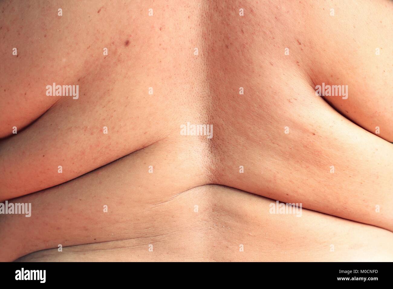 Asiatische dicke Frauen hat Übergewicht. zeigt Sie überschüssiges Fett von der Rückseite Stockfoto