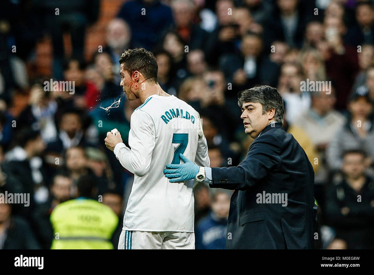 Madrid, Spanien. 21 Jan, 2018. Auf dem Boden mit einer Wunde im Gesicht nach dem Wählen 6-1 Cristiano Ronaldo (Real Madrid). La Liga Match zwischen Real Madrid vs Deportivo de la Coruña im Santiago Bernabeu in Madrid, Spanien, 21. Januar 2018. Credit: Gtres Información más Comuniación auf Linie, S.L./Alamy Live News Credit: Gtres Información más Comuniación auf Linie, S.L./Alamy leben Nachrichten Stockfoto