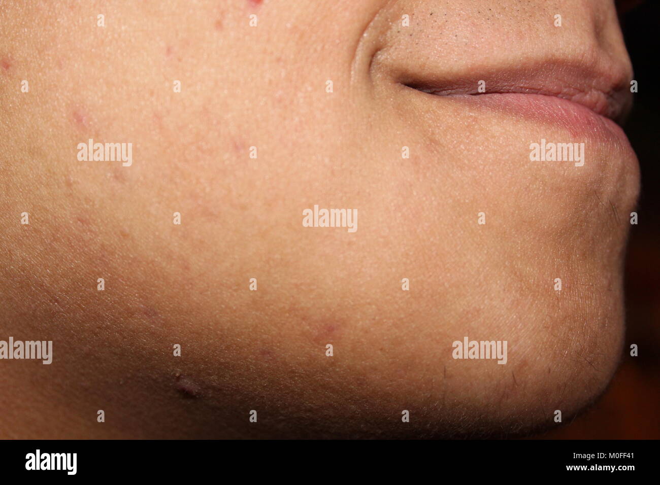 Nahaufnahme der männlichen Kinn. Stockfoto